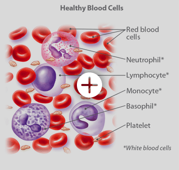健康血细胞包括阅读血细胞、中性粒细胞、淋巴细胞、单核细胞、嗜碱性细胞、血小板和白细胞